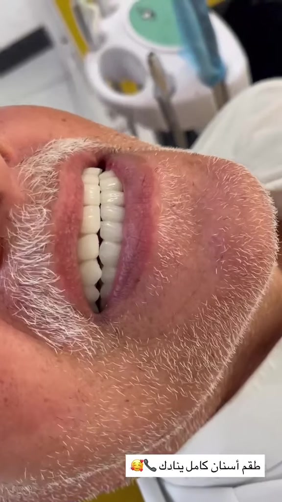 ابتسامتك اجمل مع مركز اسد التخصصي 
***********

