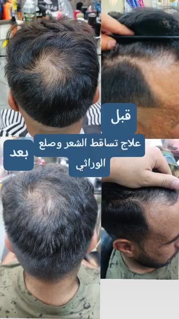 موصل وادي حجر • زيوت عبدو • وقف التساقط
