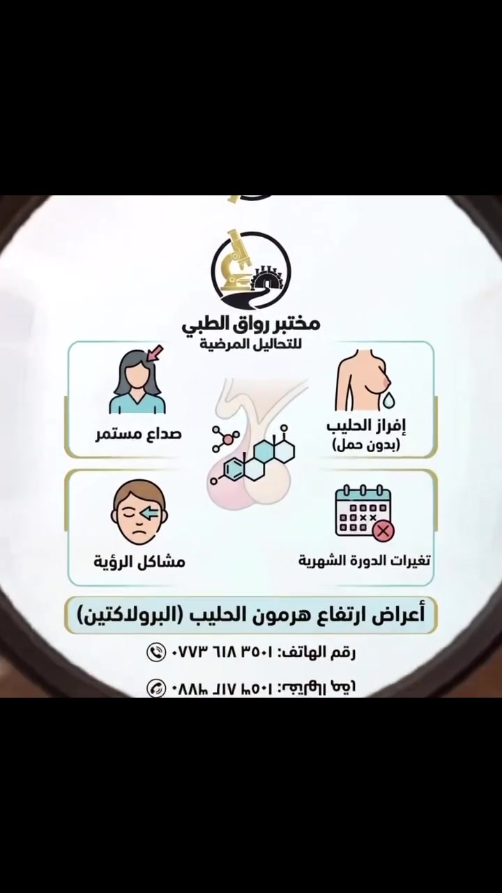 لا توجد تفاصيل
