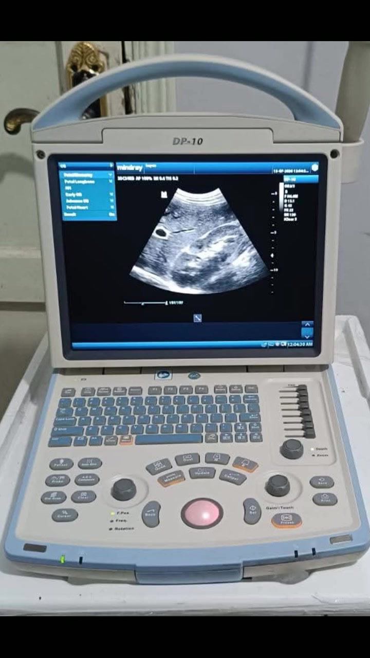 سونار mindray Dp10 الغني عن التعريف
حالة الجهاز جيدة جدا
مع بروب كونفكس باطني
للاستفسار واتس اب ***********
وبسعر جدا مناسب ⚡⚡
 #أجهزةطبيةمستعملة #أجهزةسونار#سونار #اكسبلور_فولو
#اطباء #اكسبلور_فولو
