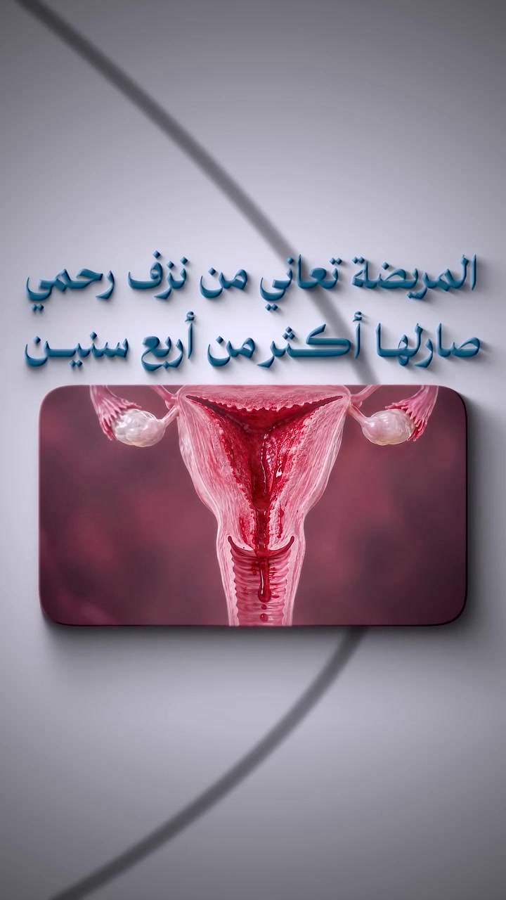 استئصال رحم متضخم بالتليفات مع الحفاظ على المبايض 🩺

أجرت د. فرح الجبوري | اختصاص نسائية وتوليد عملية استئصال للرحم نتيجة وجود تليفات، مع الحفاظ على المبايض، وتكللت العملية بالنجاح في مستشفى الواثق الأهلي.

👩🏻‍⚕️ د. فرح الجبوري
🩺 اختصاص نسائية وتوليد

📍 بغداد – ساحة الواثق / مقابل مصرف الجنوب الإسلامي
📞 *********** | ***********

مستشفى الواثق الأهلي… اسمٌ تثقُ به.
