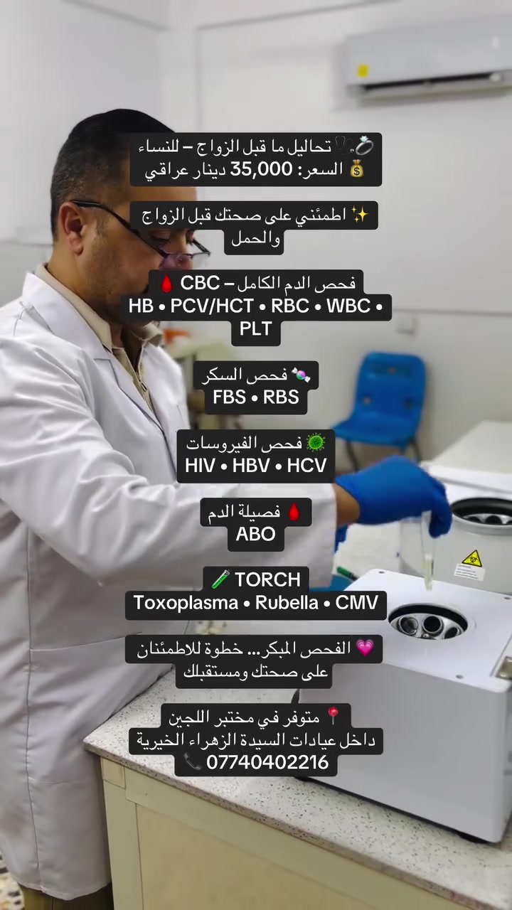 لا توجد تفاصيل
