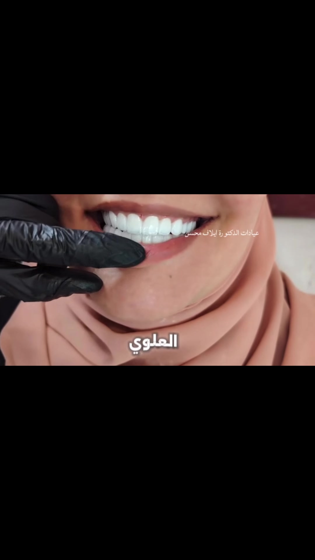 عيادة أسنان • تجميل أسنان • دكتورة إيلاف محسن