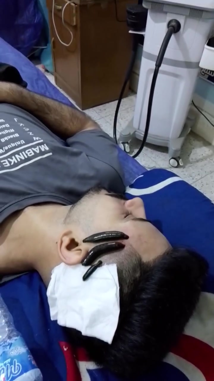 عيادة دار الشفاء • العلاج الطبيعي • حجامة