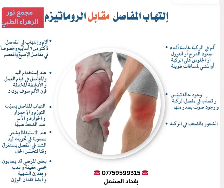 ❤التهاب المفاصل مقابل الرواتيزم!!!!!!!!!!!!!!
#المفاصل#الروماتيزم
