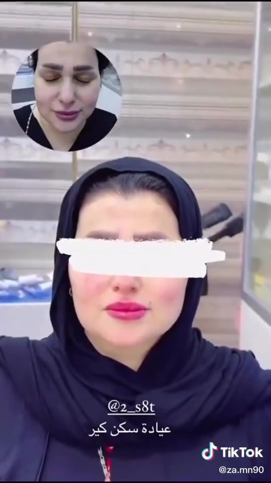 جمالك يستاهل العناية والاهتمام 💕
💉 عروض مميزة على الفيلر وحقن النضارة
✨ نتائج ناعمة ولمسة تجميلية تبرز جمالج
🌸 أسعار خاصة لفترة محدودة
لا تفوتين العرض 🤍
📍 سكن كير لليزر والتجميل
📞 ***********
احجزي موعدج هسه وخلي جمالج يحچي عنج 💗✨
سكن كير لليزر والتجميل
