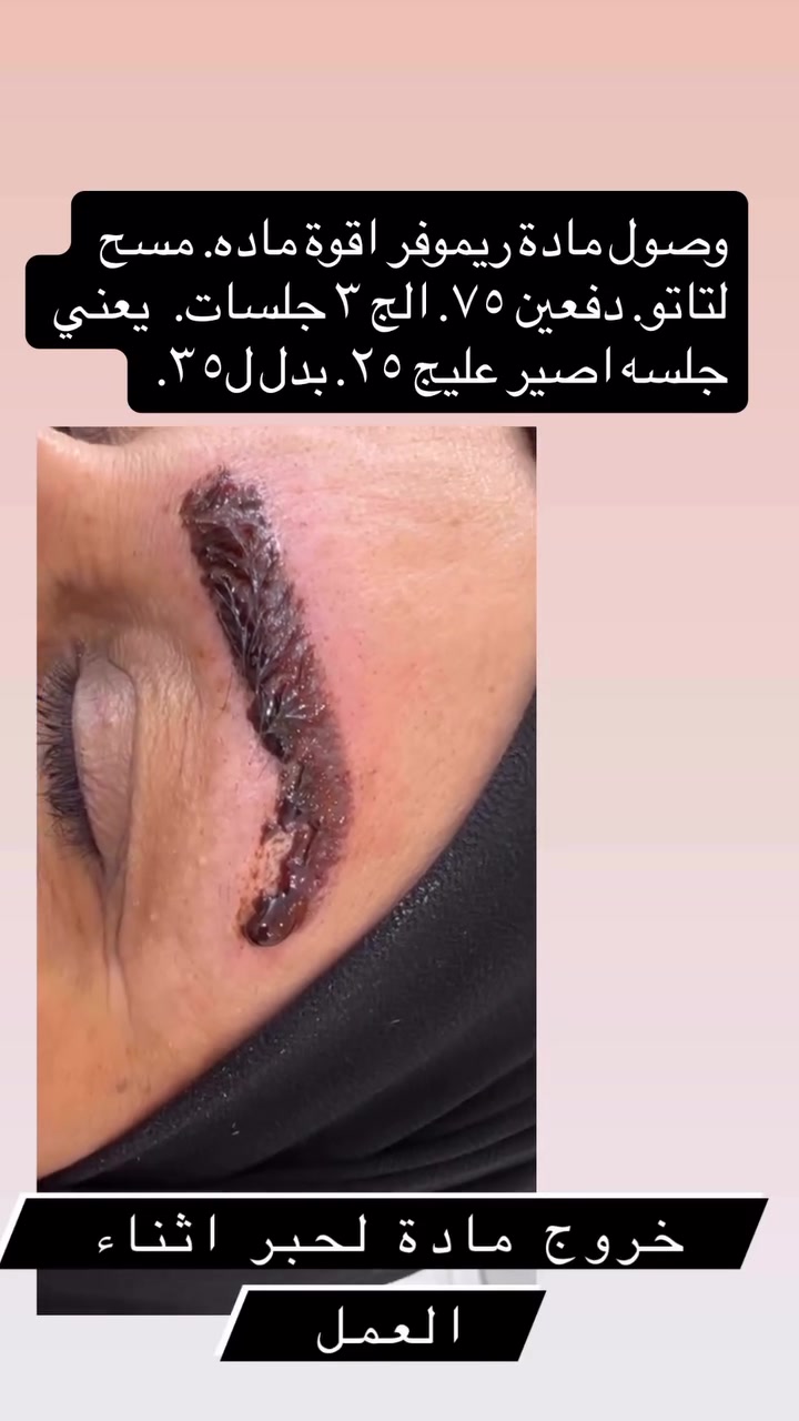 شوفولي لعروض بنات مسابقاتنه راح تستمر تفاعلكم بمشاركةً منشوراتنه بكروبات سماوةً اكثر وحدة تتفاعل راح تفوز ويانه بجائزة حلوة

صالون نيولوك

عنوان غربي ثاني شارع حجي سليمان  بصف الجامع عمارة بيضة دخلي بفرع العمارة 

 *********** مفتوح الصالوون يوميا من  ٩ صباحا الى ٨ مساء.
