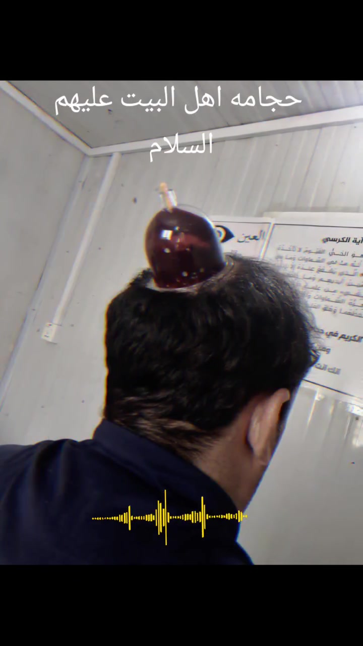 الحجامه الوقائيه والعلاجيه
حجامه اهل البيت (ع)
استخدام كؤس الحجامه مره واحده
نهايه شارع السوداني 
للاستفسار ***********

