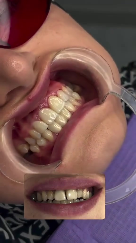 اهتم بصحة أسنانك وجمال منظرها مع مركز اسد التخصصي 
***********
