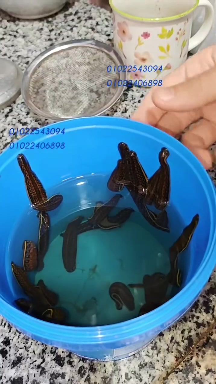 العلق الطبي • دوالي الساقين • بلال شحاتة