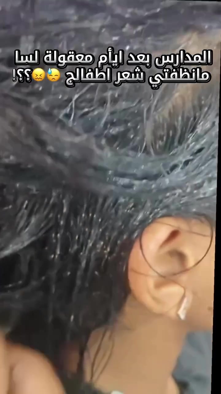 جهاز ازالة القمل وصبيان.  لطلب والاستفسار 
***********