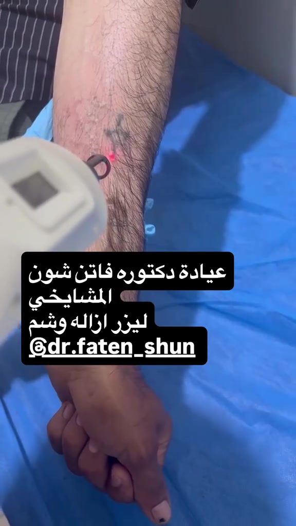 تتواجد يومياً الدكتوره فاتن شون المشايخي
اختصاص جلديه تجميليه والليزر وتساقط الشعر 
رقم الحجز ***********

