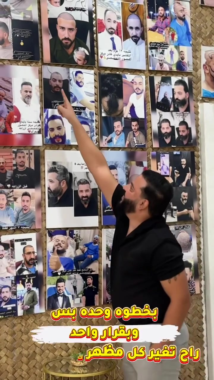 نتيجه زراعه شعر الرأس واللحيه للاستاذ احسان بعد مرور ٤ سنوات من اجراء العمليه 🤍

مانحتك ضعيفة؟ 
وگالولك مستحيل تنزرع بجلسة وحدة؟

لا تستعجل وتدفع كلفة جلستين قبل ما تعرف رأي الكادر الطبي المختص .

🔻بمركز المنصور، الحالات اللي غير مراكز تعتبرها صعبة أو تحتاج أكثر من جلسة، 
عدنا إلها حلول مدروسة 
بفضل خبرتنا الكبيرة بزراعة الشعر للحالات ذات المانحة الضعيفة.

ليش تدفع مرتين وتنتظر مرتين إذا ممكن تحصل على النتيجة بجلسة وحدة؟

شوف بنفسك الحالات والنتائج الحقيقية، واعرف ليش مركز المنصور صار الوجهة الأولى لأصحاب المانحات الضعيفة والصلع الواسع.

✅ اختصاص المانحات الضعيفة
✅ استغلال أمثل للمنطقة المانحة
✅ كثافة طبيعية وخط جبهة مدروس
✅ آلاف العمليات الناجحة

المكان اللي يحوّل أصعب الحالات إلى قصص نجاح. �

زورنا لموقع العياده
بغداد المنصور شارع الرواد مقابل مرطبات مشمشه
او الاتصال
***********
