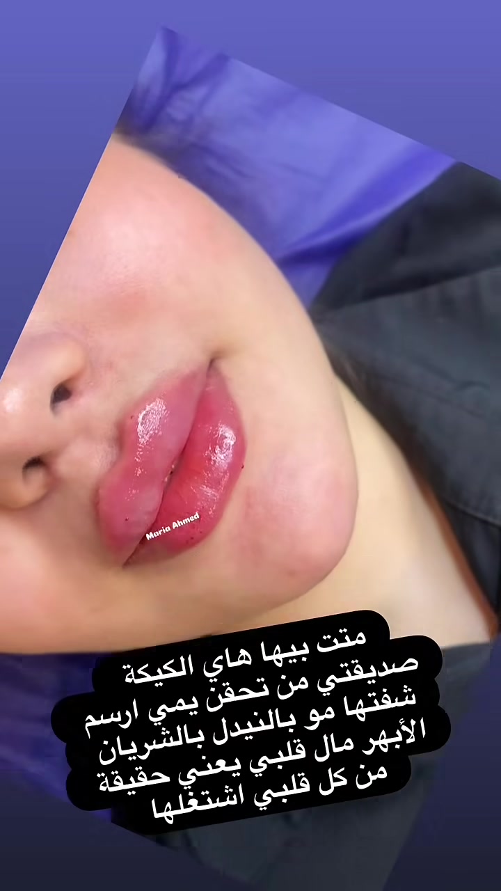 #فلر_شفه

@إشارة
