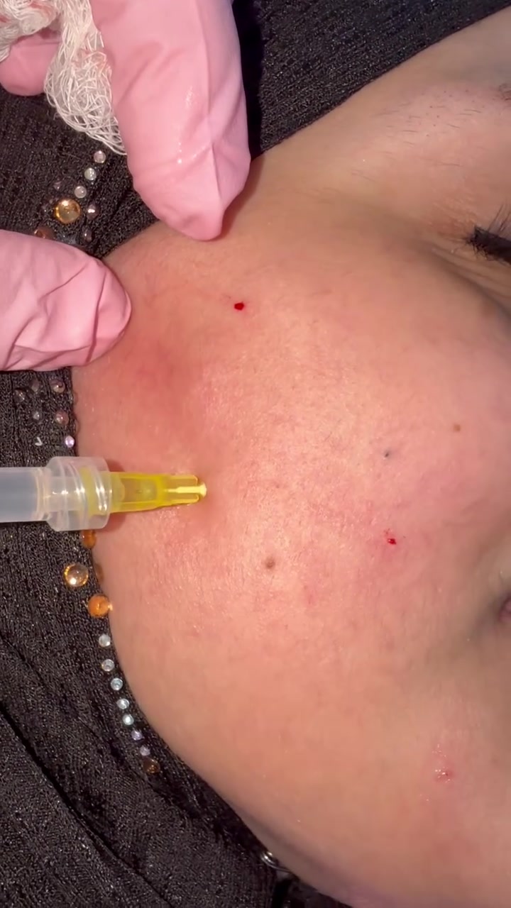 ✨ SALMON GLOW ✨

لأن بشرتچ تستحق نضارة تليق بيچ 🤍

💉 حقن نضارة السلمون
لمظهر أكثر إشراقاً وحيوية ونضارة ✨

دلّلي بشرتچ…
وخلي الإشراقة تحچي عنچ 🌸

♡ عيادة حور ♡

📍 بغداد | الحسينية – السوق الكبير
مقابل مطعم السواعد

📞 ***********
للحجز والاستفسار
