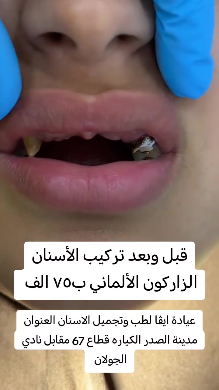 حشوة تجميلية • تقويم بالتقسيط • زراعة الأسنان