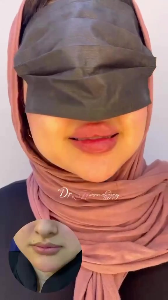 حنين العزاوي • الحسينية • فلر بوتوكس