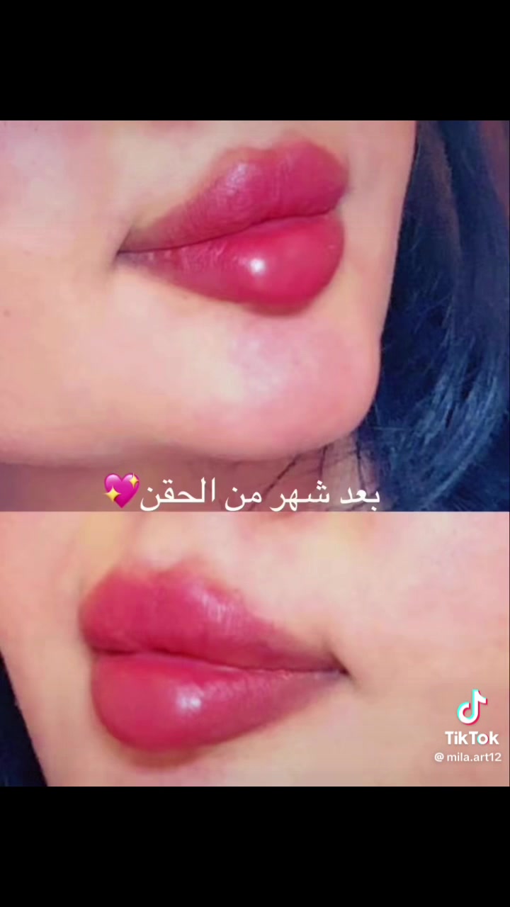 اهلا وسهلا جميلتنا عروض سبوت يرحب بيكم مستمره للحجز الاتصال على الارقام التاليه***********
