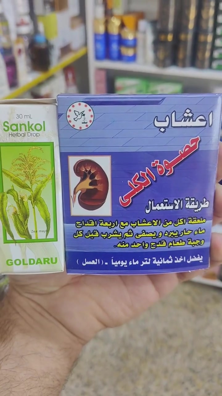 علاج حصوة الكلى • قطرات سانكول • الحي العصري
