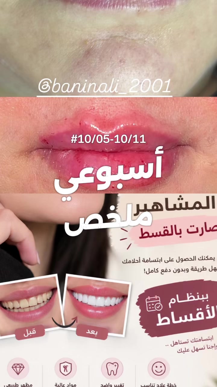 ابتسامة المشاهير • تقسيط • حي العامل