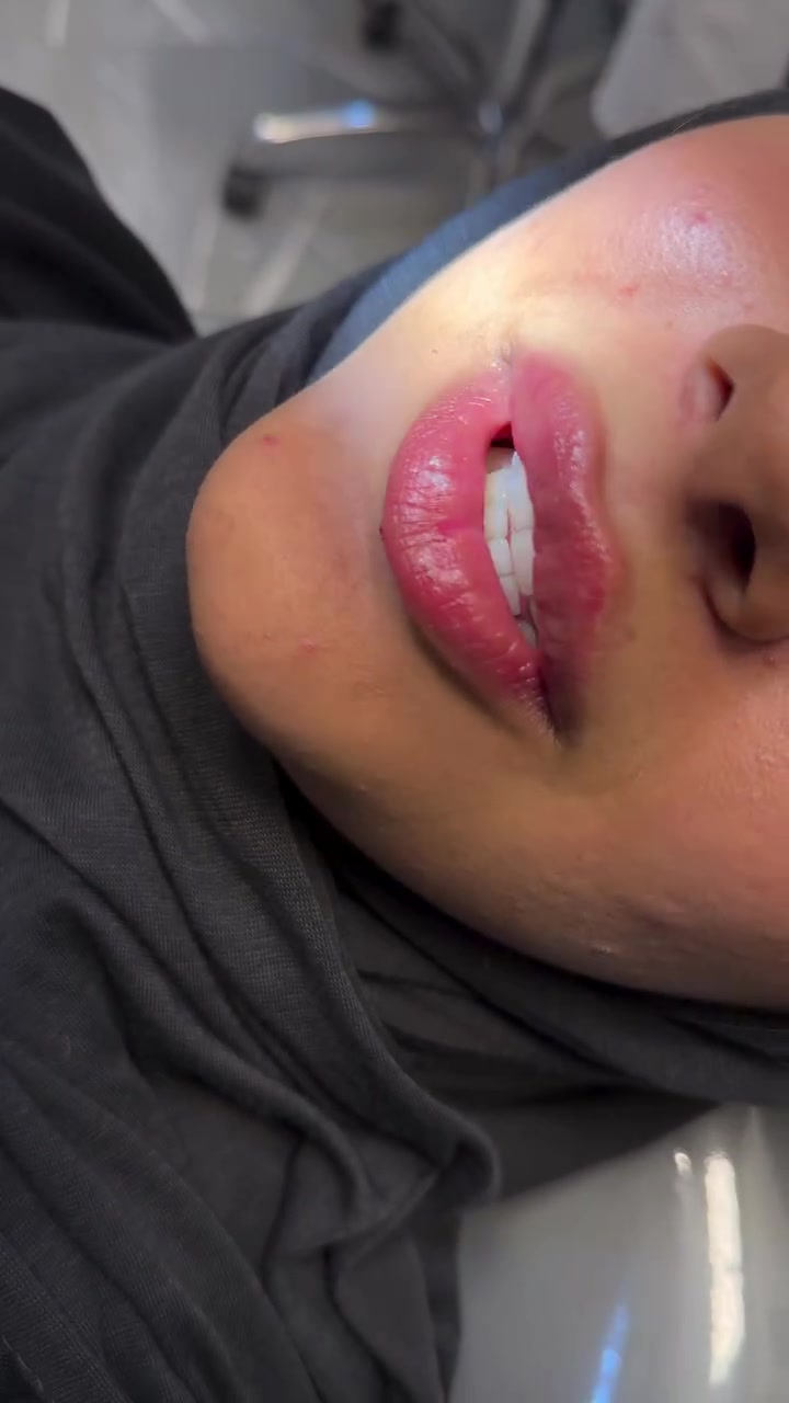 عيادة بتول • تجميل لاجراحي • البساتين
