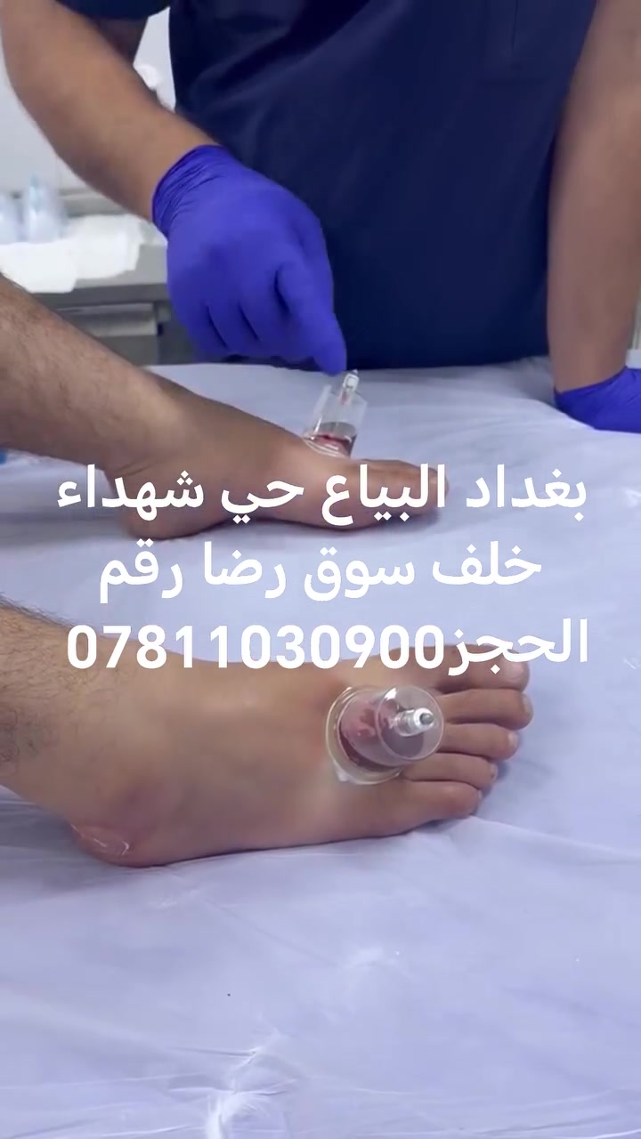 حجامه • البياع • حي شهداء