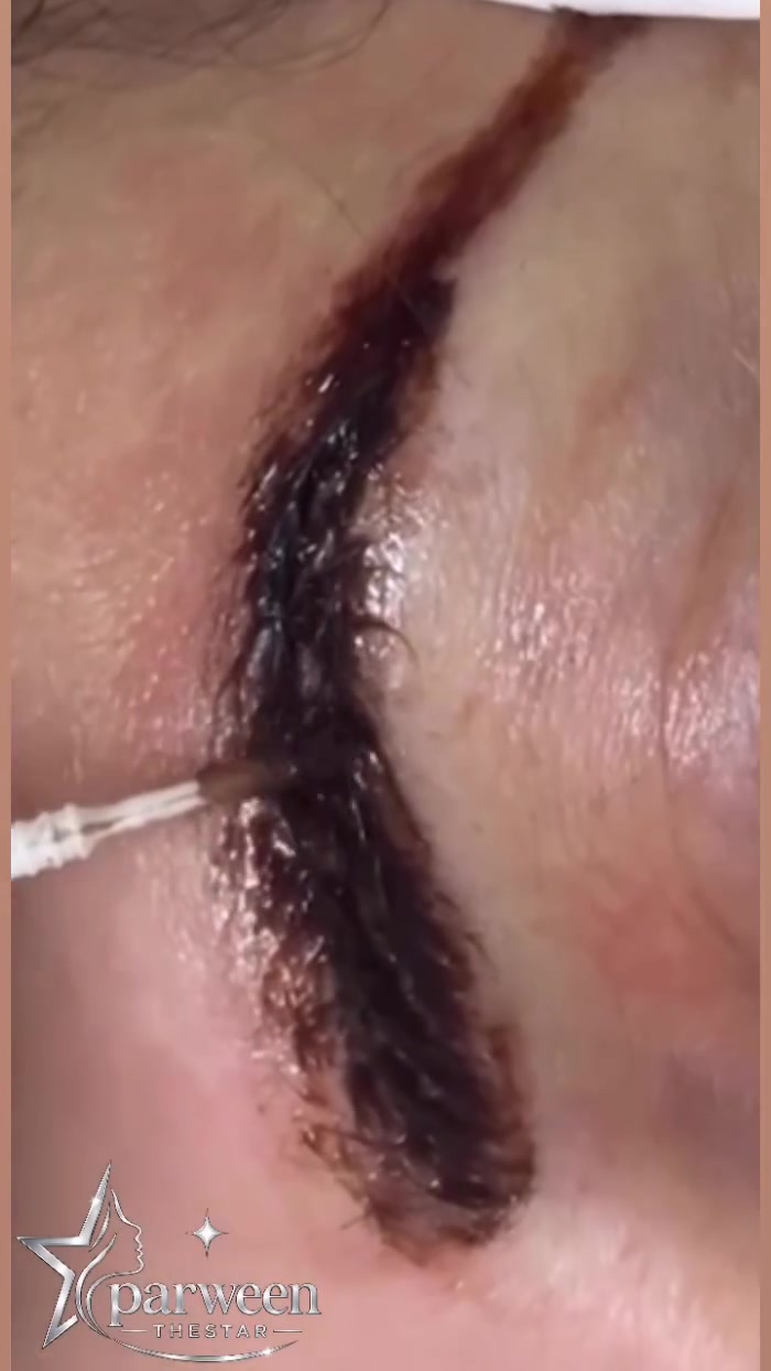 الحل الحقيقي لتحرر 

من عذاب التاتو (part2 )

تعانين من تاتو قديم وشكله مغير لون حواجبكِ؟ 💔

تعبتِ من التغطية والتعديل اللي يسوء المظهر؟

 الحل مو بتكرار التاتو.. الحل هو التحرر منه وإرجاع ملامحكِ الطبيعية بمادة آمنة تماماً ✨

📍 المكان: ديالى - خان بني سعد (مقابل المستوصف البيطري)

💬 دزي صورة حواجبكِ مباشرة على الواتساب

***********
أو اكتبي (مسح) بالتعليقات وراح أساعدكِ 🤍

Parween.thestar

