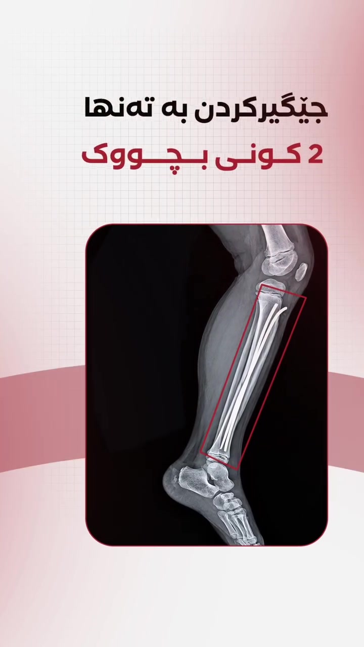 طبيب أطفال • علاج سهل • د. سيروان جاف