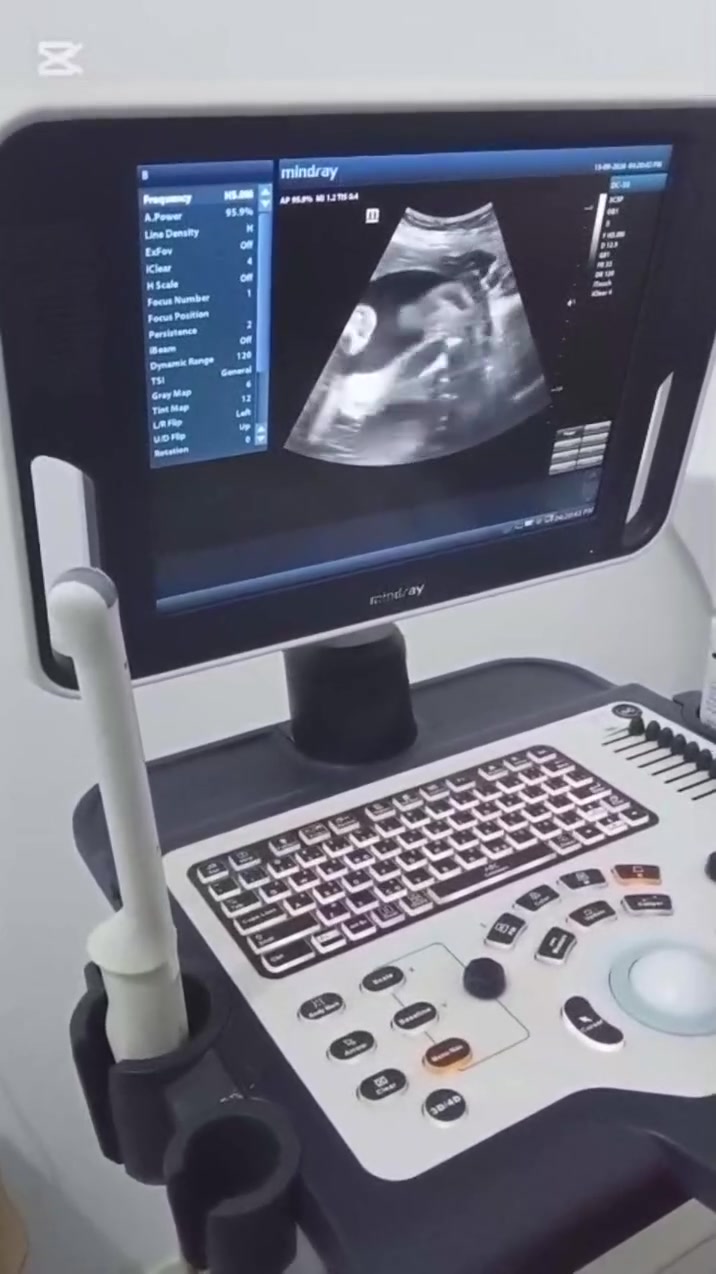 بعد انتظارٍ دام 8 سنوات… 🌸
وبعد انقطاعٍ  الحمل، عادت الفرحة من جديد 🤍
رزقت مريضتنا الجميلة ببنتها 👶🏻🎀
قصة جديدة تُثبت أن الأمل لا ينتهي…
وأن بعد الصبر فرحة تستحق الانتظار 🤍

عيادة د. ميس باقر سفاح الميالي
اختصاص نسائية وتوليد ورعاية الحوامل
وسونار حديث ودقيق
📞 للحجز: ***********
📍 ذي قار – قضاء الفجر – شارع الصيدليات، مجاور مخبز سويح شجر
