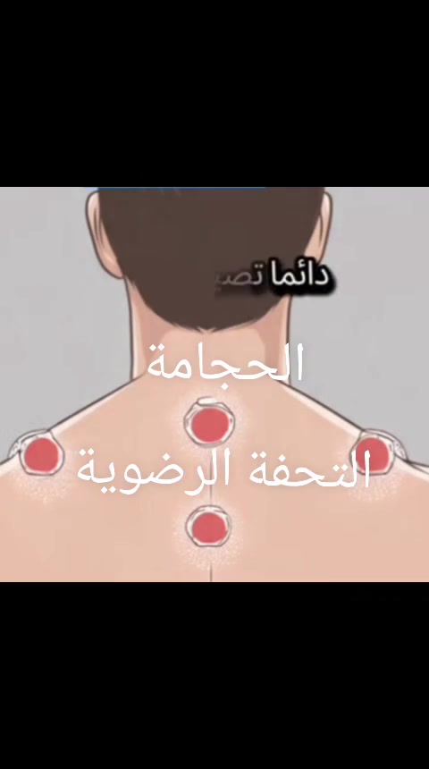 بغداد الحسينيه/السوق الثاني قرب مرطبات العذراء ♍  مجاور ستوديو الجمهورية مقابل ابو باقر للشاي مقابل القاعة الرياضية لبناء الاجسام هاتف
يوجد كادر نسائي متخصص
 📞 ***********
بغداد الحسينيه/السوق الثاني قرب مرطبات العذراء ♍  مجاور ستوديو الجمهورية مقابل ابو باقر للشاي مقابل القاعة الرياضية لبناء الاجسام هاتف
