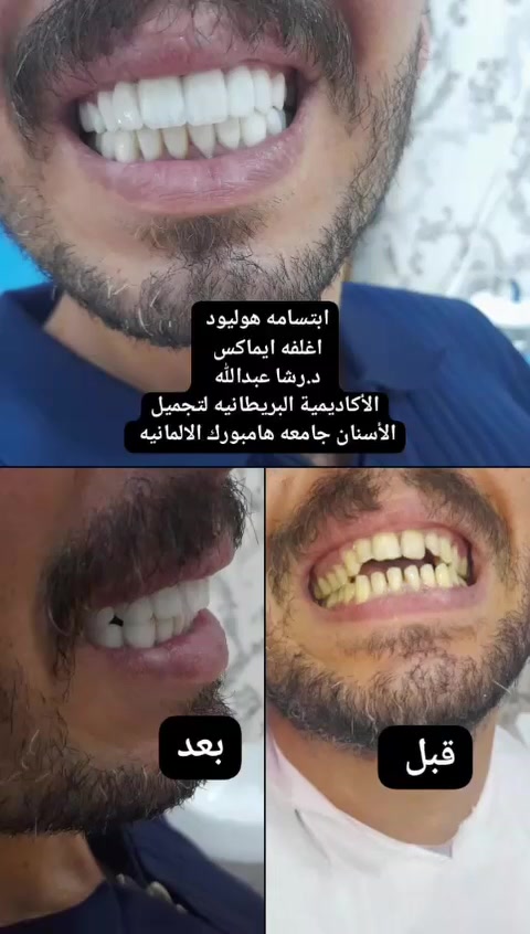 الاعظميه سبع ابكار قرب جوهره لبنان الثانيه مقابل مطعم هم هم طابق اول عياده د رشا عبدالله حمود 🌸🌸💐 ***********

