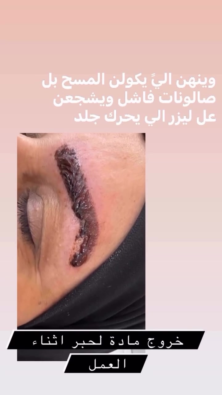 شوفولي لعروض بنات مسابقاتنه راح تستمر تفاعلكم بمشاركةً منشوراتنه بكروبات سماوةً اكثر وحدة تتفاعل راح تفوز ويانه بجائزة حلوة

صالون نيولوك

عنوان غربي ثاني شارع حجي سليمان  بصف الجامع عمارة بيضة دخلي بفرع العمارة 

 *********** مفتوح الصالوون يوميا من  ٩ صباحا الى ٨ مساء.
