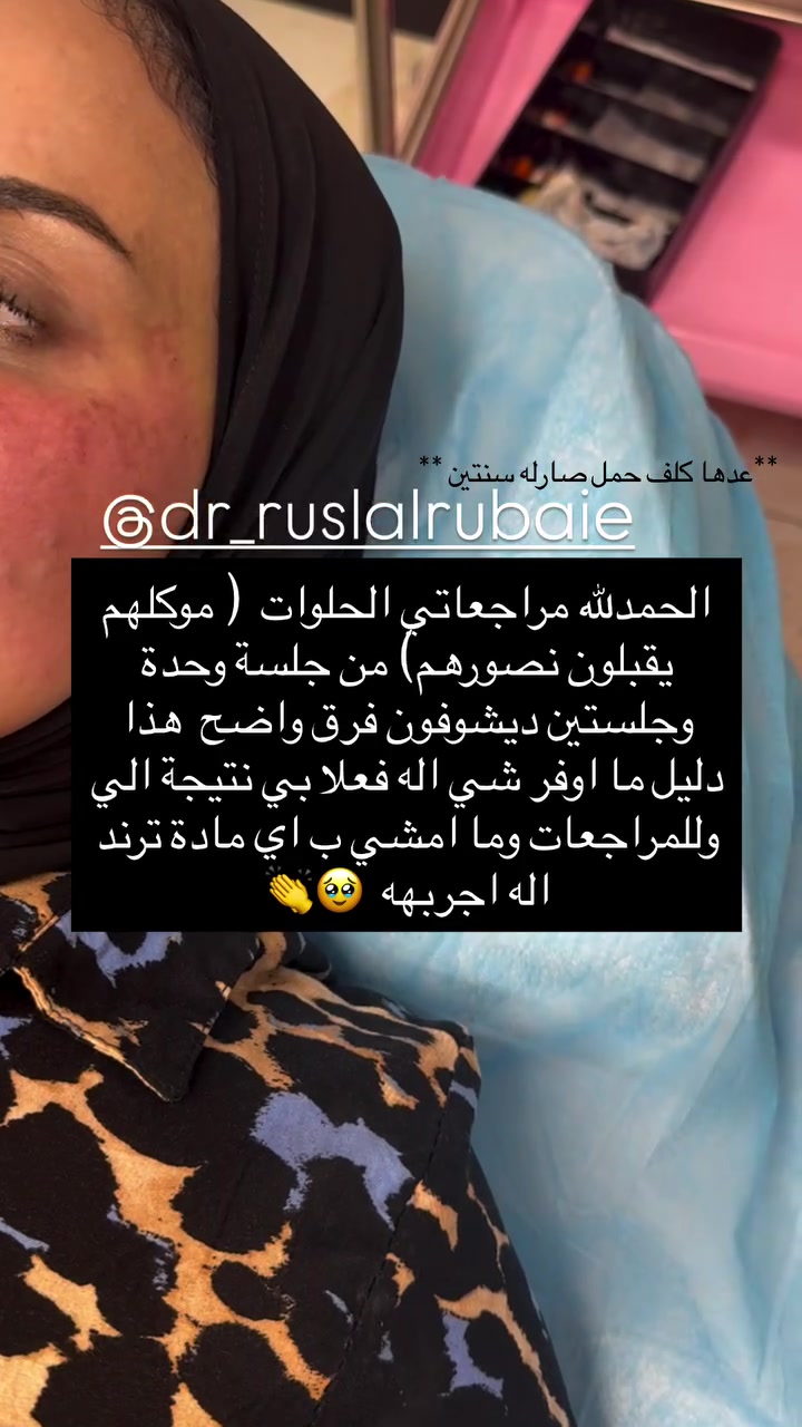 هواي دزيتولي على عروض
فرحة الزهرة وموسم اعراس وحفلات ونريد نفرح تدللون

بعد مانزلت ان توفرت ماشاءالله المسجات متوقفت💗 بس هالمرة الكمية تكفي الكل ان شاءالله وكلكم تلحكون تسوون تغييرات حلوة والعروض مستمره بلشت من اليوم 

 خلص العروض صارت جاهزة 
ومراح تتكرر ابداً هيج عروض لان بيها جلسات فري 🎁 تستفادون منها كلش هواي خصوصا الي يحتاجون عدة جلسات 🎁💗

بس لخاطرر تفرحون بمناسباتكم وتسوون كلشي عاجبكم

والمهم المواد مسجلة ومفحوصه من وزارة الصحة 
العروض تكدرون تراسلونا على الدايركت او على الواتساب مسج
***********

العنوان المسيب شارع البلدية تواجدي يكون ايام معينة بالمسيب وباقي الايام كلها بغداد لذلك يرجى الحجز قبل الحضور 💗🎁
