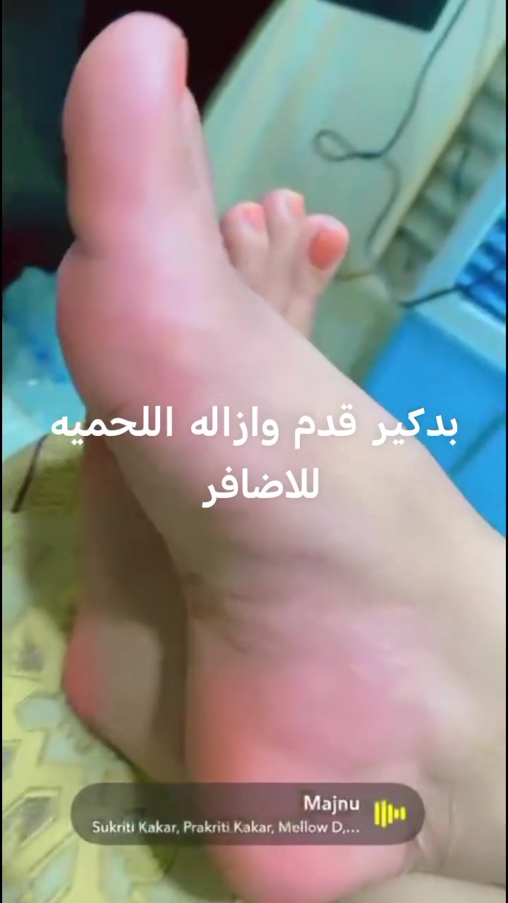 صالون منسه • بدكير قدم • إزالة لحمية