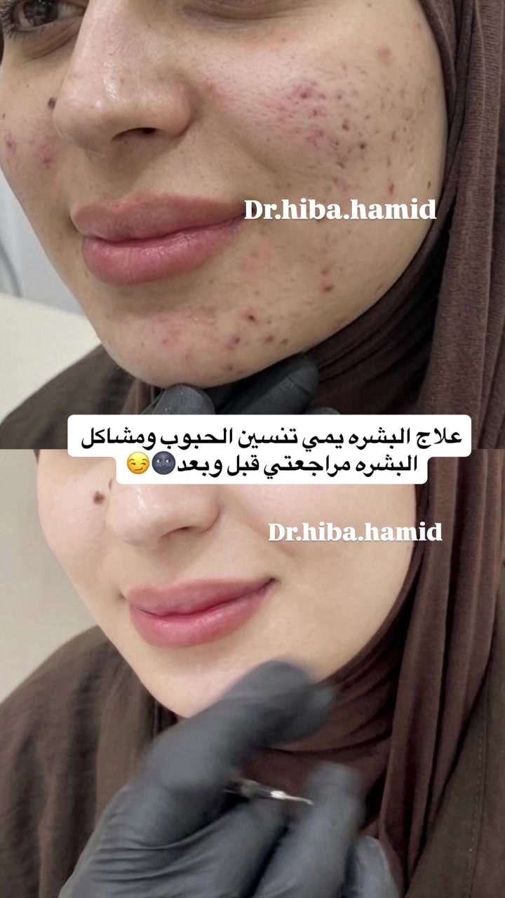 بنات حبايب الموقع النواب عمارة كراند جكن للحجز التواصل مع الرقم ***********
