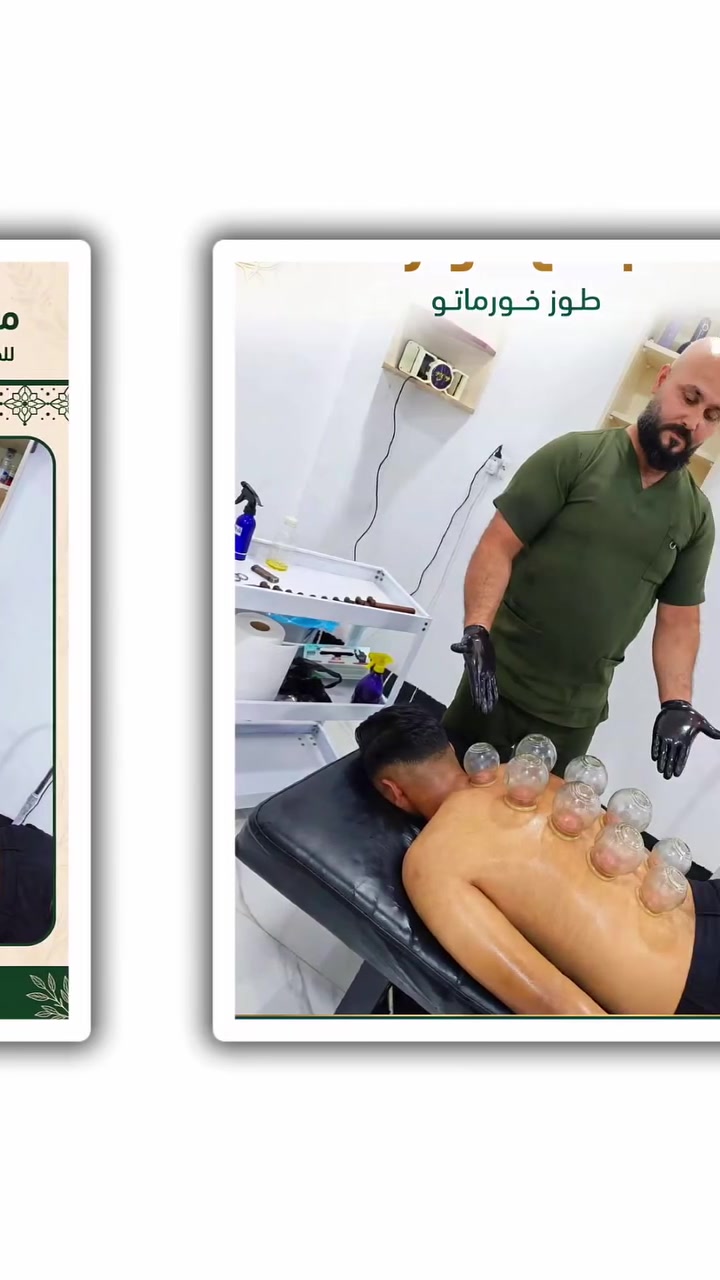مساج استرخاء • حجامة • طوز خورماتو