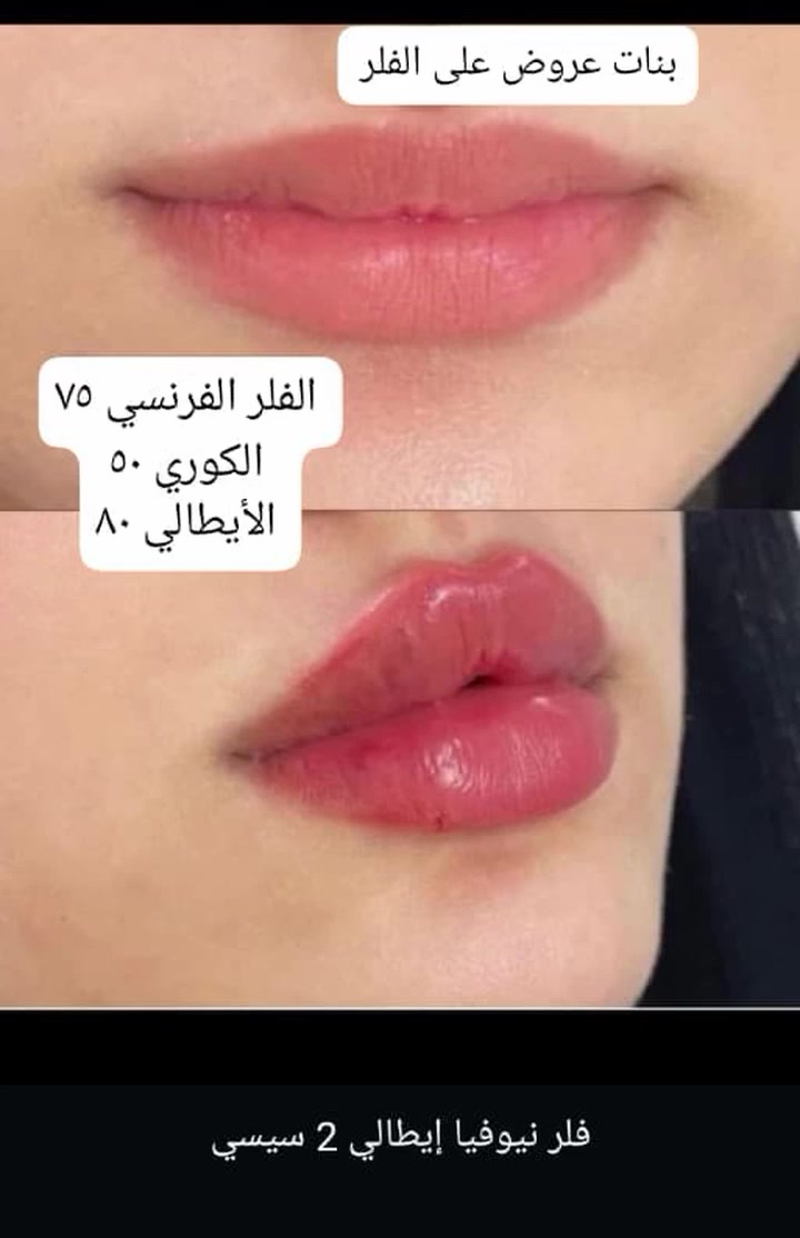 𝒲𝒶𝓇𝒹𝒶 𝐵𝑒𝒶𝓊𝓉𝓎 🎀 
🌷 ورده بيوتي 🌷 
الخطيب الزراعي شارع المولده الحمره شارع عيادات صحتي 
للحجز مراسله الصفحه الرئيسيه 
او مراسله الرقم واتساب ***********
#شعب_صيني_ماله_حل😂❤️‍🩹فولو #فولومي #فولورز #اكسبلور_فولو #ضيفوني #الاكسبلور_فولو💕 #لايك_مي #بيع_لايكات #لايكاتكم_تسعدني #لايك_كومنت #تعليقات #تعليقاتكم_تسعدني😍 #تعليق #تعليقاتكم_تسعدني #متابعة_للبيج #ضيفو #اكسبلور #لقطة #لايك #دعم #تفاعل #لايكات #كومنت #كومنتات #اكسبلور
