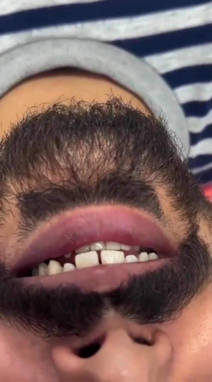 "أنت تستحق ابتسامة ساحرة!"

متواجدين لخدمتكم طيلة أيام الأسبوع #الشركة_الطبية_العالمية 

🔻
🏢 العنوان / بغداد _ بسماية _ الشارع العام  . مجاور ماركت الغدير 
فوق مطعم بي تاون
📲 للحجز والاستفسار 
***********
#مركز_بسماية_لطب_وتجميل_الاسنان
