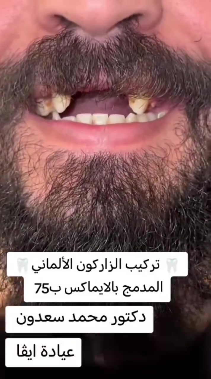 عيادة ايفا • دكتور محمد سعدون • الكياره قطاع٦٧