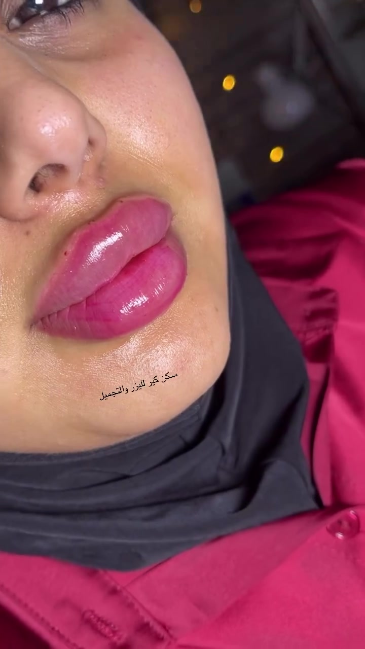 🌸 عروض سكن كير لليزر والتجميل 🌸
لفترة محدودة... دللي نفسج بأفضل العروض وأسعار ما تتعوض! ✨
💖 أحدث الأجهزة 💖 نتائج مميزة 💖 بإشراف مختصين
📍 سارعوا بالحجز قبل انتهاء العرض. 📞 ***********
#جلديه #حقن #بوتكس #فلر #ليزر

