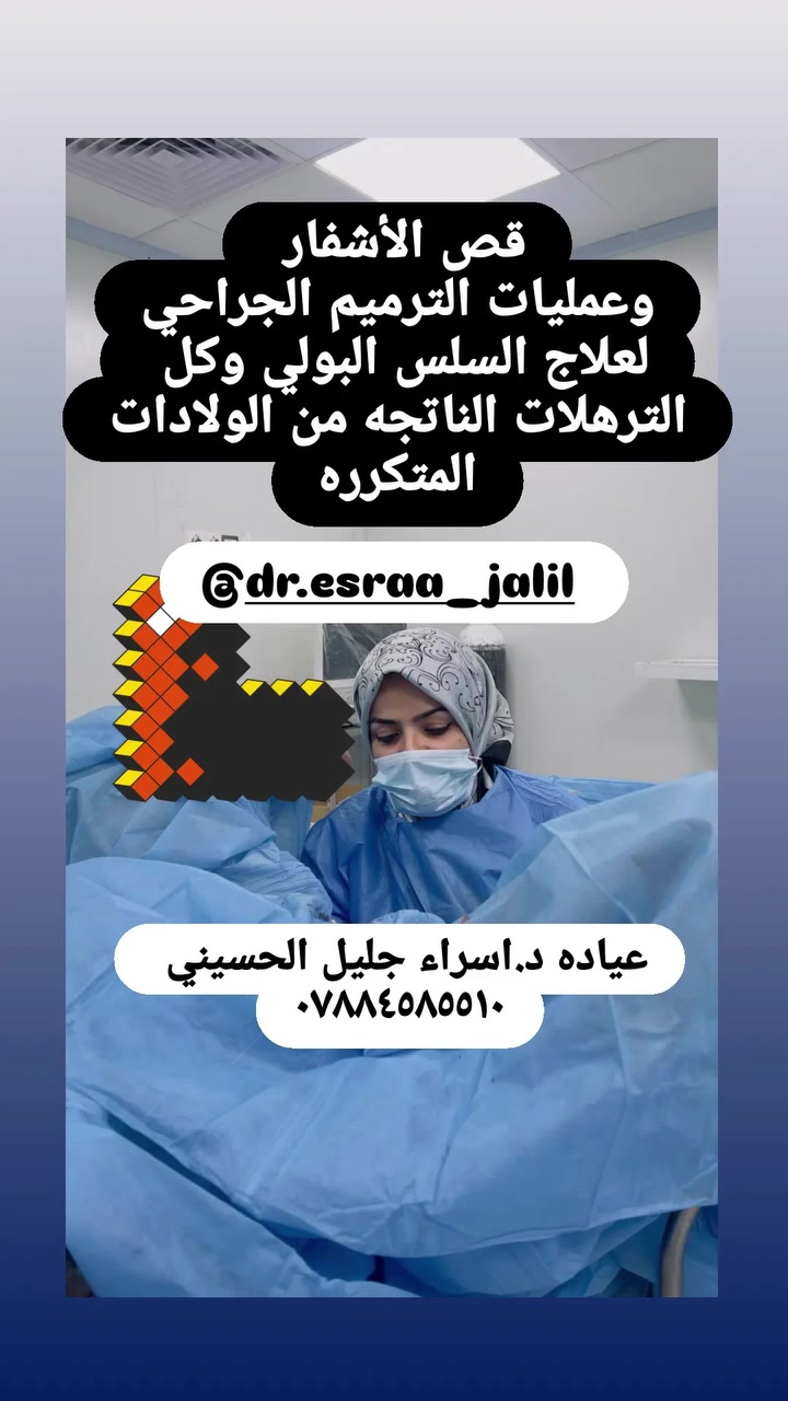 لا توجد تفاصيل
