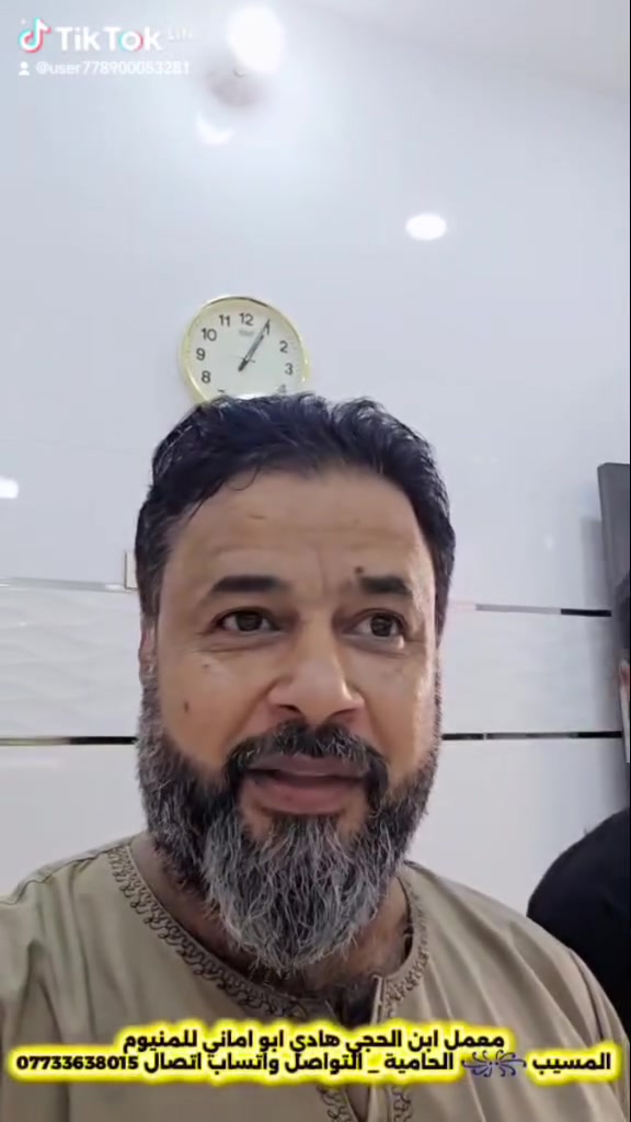 بابل الحصوة • كاونتر • الالمنيوم