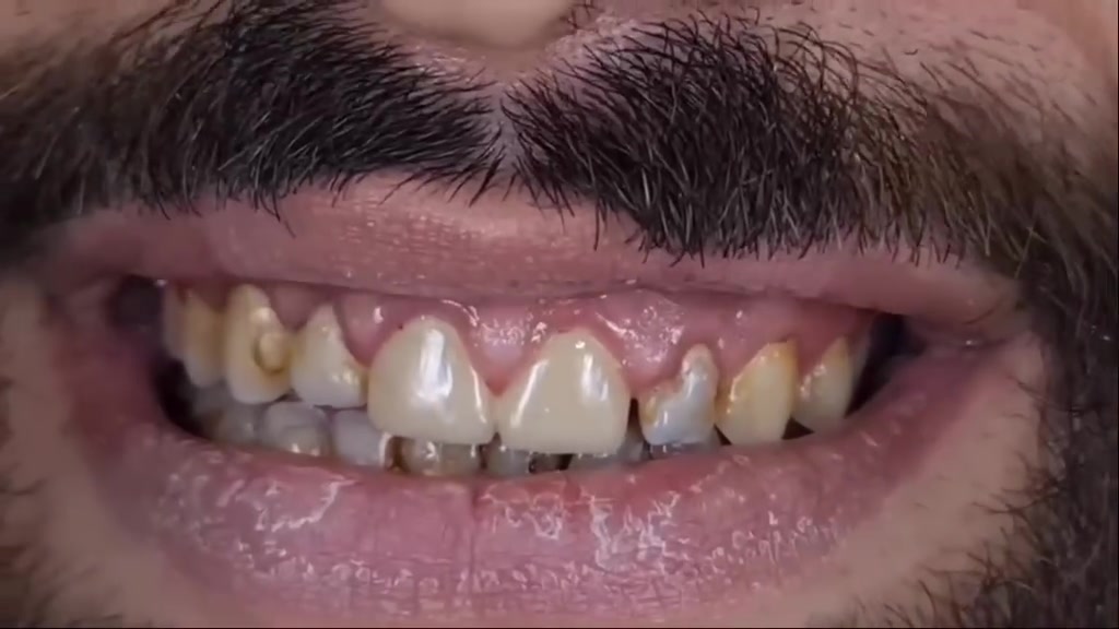 اهتم بصحة أسنانك مع مركز اسد التخصصي 
العنوان بغداد المدائن شارع الاطباء مقابل مجمع البيت الاصفر 
***********

