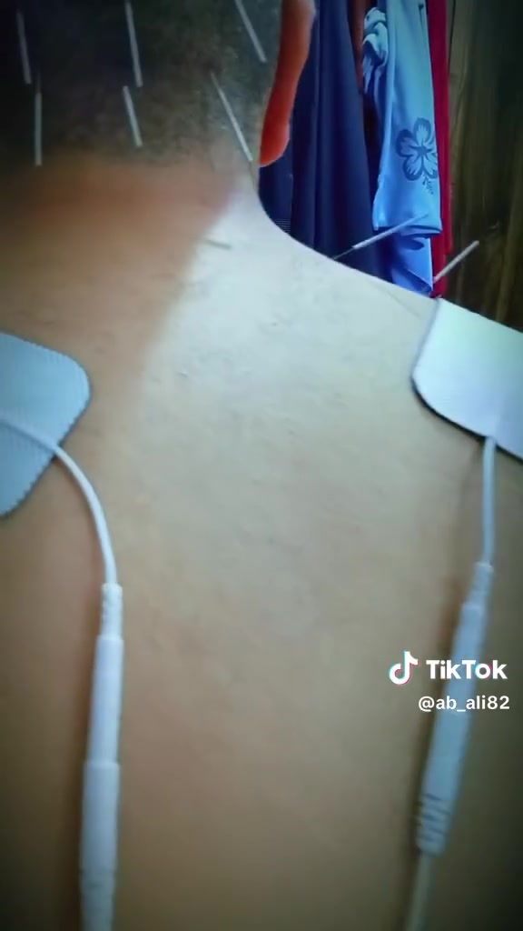 عيادة دار الشفاء للحجامة والعلاج الطبيعي علاج الانزلاق الغضروفي العنقي الحسينية شارع ابو سمير مقابل أسواق العائلة ***********
