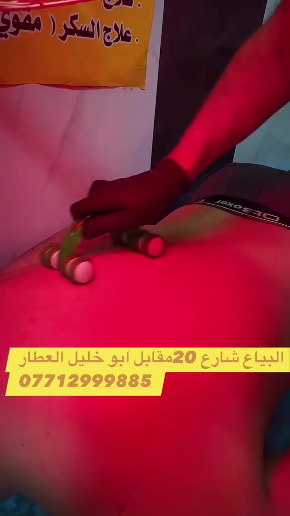 تم افتتاح مركز مكة المكرمه للتداوي بالطب النبوي (الحجامه )بالطرق العلميه الحديثه والعلاجات المتطوره 
العنوان البياع /شارع ٢٠-بالقرب من دائرة الكهرباء -مقابل ابو خليل العطار 
***********
***********
