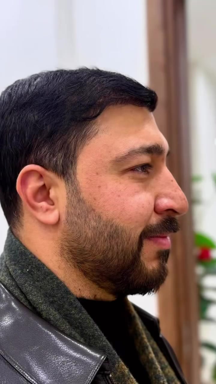في مركز المتخصص لزراعة الشعر…

نحن نؤمن أن العمل ليس مجرد مهنة،
وأن نجاح الإنسان لا يُقاس بكثرة ما يقول… بل بصدق ما يقدّم.

لا نؤمن بالغش،
ولا بالوعود التي لا يمكن تحقيقها،
ولا باستغلال حاجة الناس من أجل الإعلان أو الربح.

نؤمن أن الكفاءة مسؤولية،
وأن الأمانة أساس الثقة،
وأن إتقان العمل عبادة قبل أن يكون نجاحاً.

نعمل بضمير…
ونخطط بعلم…
ونُنجز بكفاءة…

لأننا نعرف أن خلف كل مراجع ثقة منحها لنا،
وخلف كل نتيجة مسؤولية يجب أن نكون أهلاً لها.

إتقان العمل يرضي الله…
والصدق في العمل يكسب ثقة الناس.

وفي مركز المتخصص لزراعة الشعر،
لا نبحث عن نجاحٍ مؤقتٍ بإعلانٍ جميل…

بل نبني سمعتنا بنتيجة صادقة،
وعملٍ متقن،
وثقةٍ تبقى بيننا وبين أنفسنا 

مركز المتخصص لزراعة الشعر
حين يكون العلم أمانة… والنتيجة مسؤولية.

📍 بغداد – زيونة – مجاور مؤسسة هشام الذهبي

*********** واتساب للحجز 
*********** واتساب 
 ***********  للحجز واتساب #للحجز
