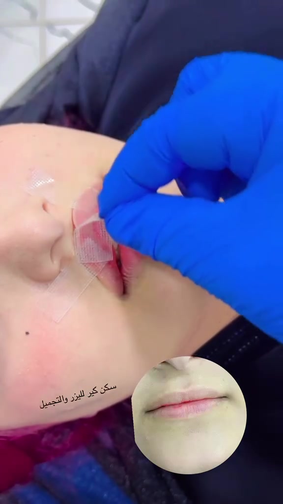 جمالك يستاهل العناية والاهتمام 💕
💉 عروض مميزة على الفيلر وحقن النضارة
✨ نتائج ناعمة ولمسة تجميلية تبرز جمالج
🌸 أسعار خاصة لفترة محدودة
لا تفوتين العرض 🤍
📍 سكن كير لليزر والتجميل
📞 ***********
احجزي موعدج هسه وخلي جمالج يحچي عنج 💗✨
سكن كير لليزر والتجميل
