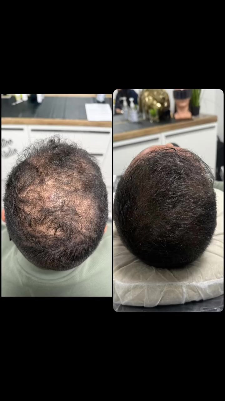 تجارب الزبائن • علاج الشعر • مراسلة الصفحة