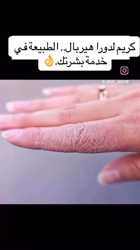 ليدورا • تساقط شعر • استشارة مجانيه