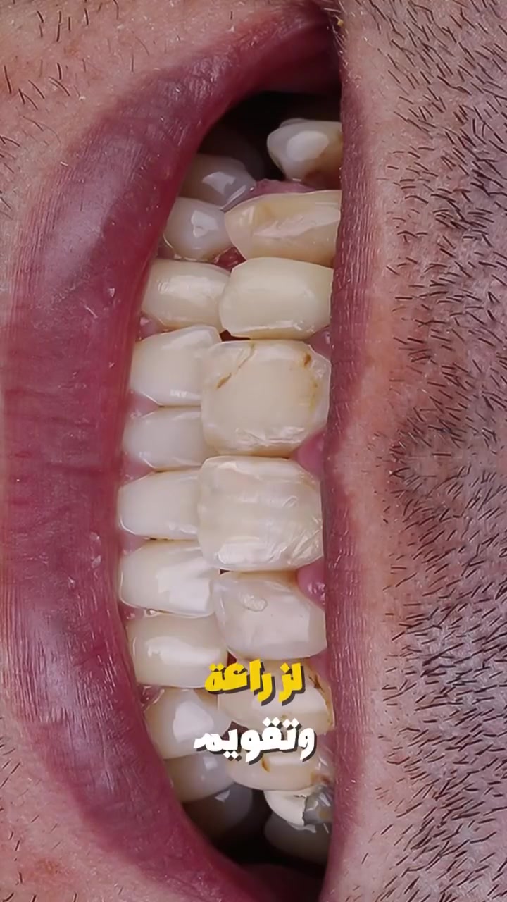 عيادة درين • تقسيط بدون فوائد • الحسينية